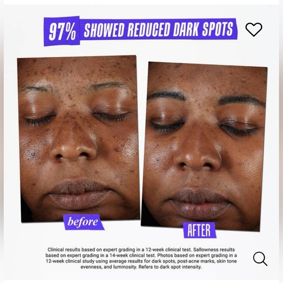 Kiehl’s • Clearly Corrective Dark Spot Solution - Picture 4 of 6